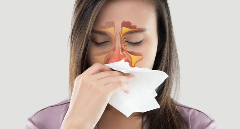 Cirugia endoscópica para sinusitis