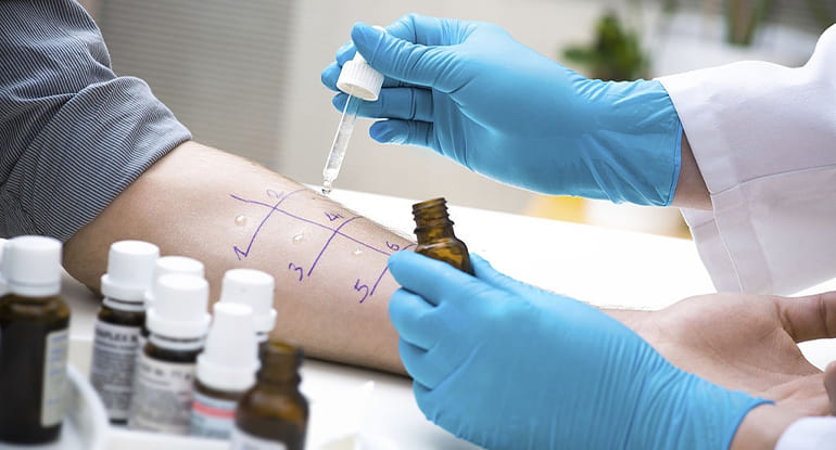 Pruebas cutáneas de alergia